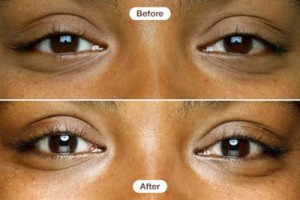 Are Eye Cremes Just A Scam? By Beauty Salon Taringa - Call Us On 07 3871 0477 Are Eye Cremes Just A Scam? By Beauty Salon Taringa - Call Us On 07 3871 0477
