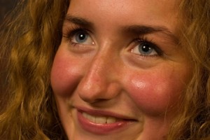 Instant Redness Reducers By Beauty Salon Taringa - Call Us On 07 3871 0477 Instant Redness Reducers By Beauty Salon Taringa - Call Us On 07 3871 0477