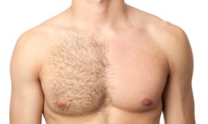 Taming The Hairy Chest 